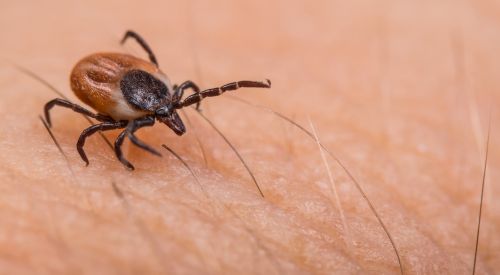 tick on person's skin